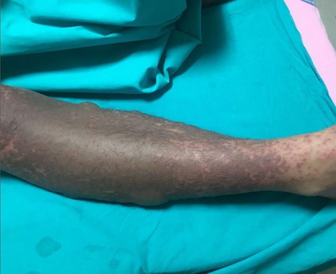 Sınav Kaygısı İ&ccedil;in Kullandığı İla&ccedil; Hastanelik Etti