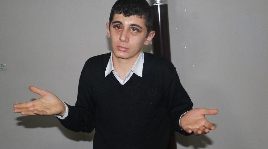 Engelli Agit&rsquo;i D&ouml;venler İ&ccedil;in 4,5 Yıl Hapis İstendi