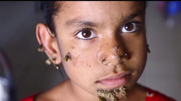 Dört bacaklı, iki penisli bebek doğdu! G4