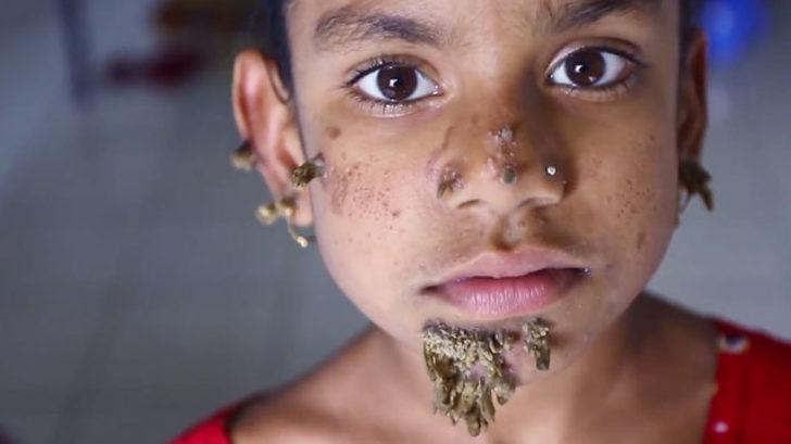 Dört bacaklı, iki penisli bebek doğdu! G5