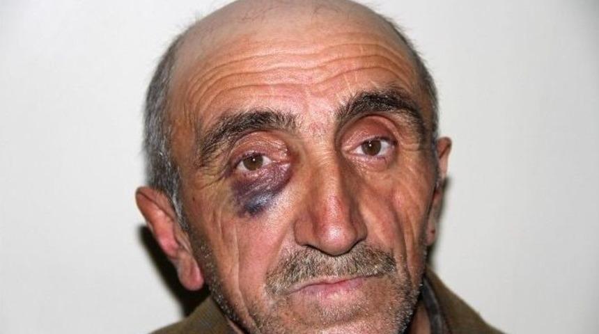 Bedelli Parası Vermeyen Babasını D&ouml;vd&uuml;