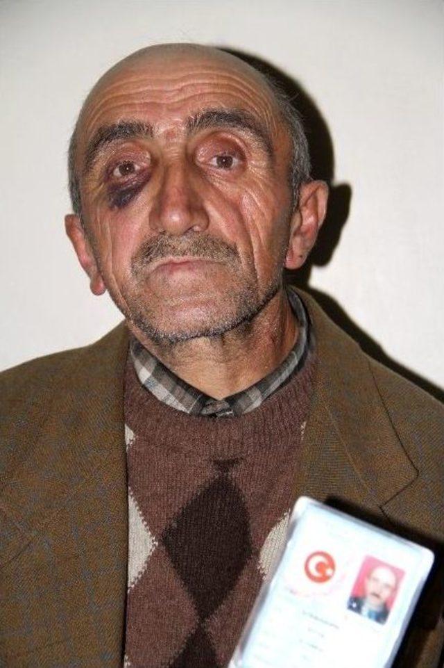 Bedelli Parası Vermeyen Babasını D&ouml;vd&uuml; 1