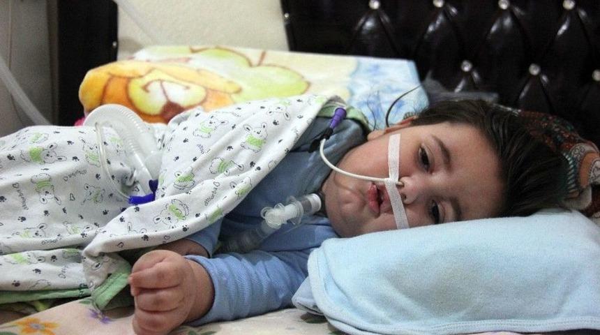 17 Aylık Bebeğin Nefesi Elektriğe Bağlı