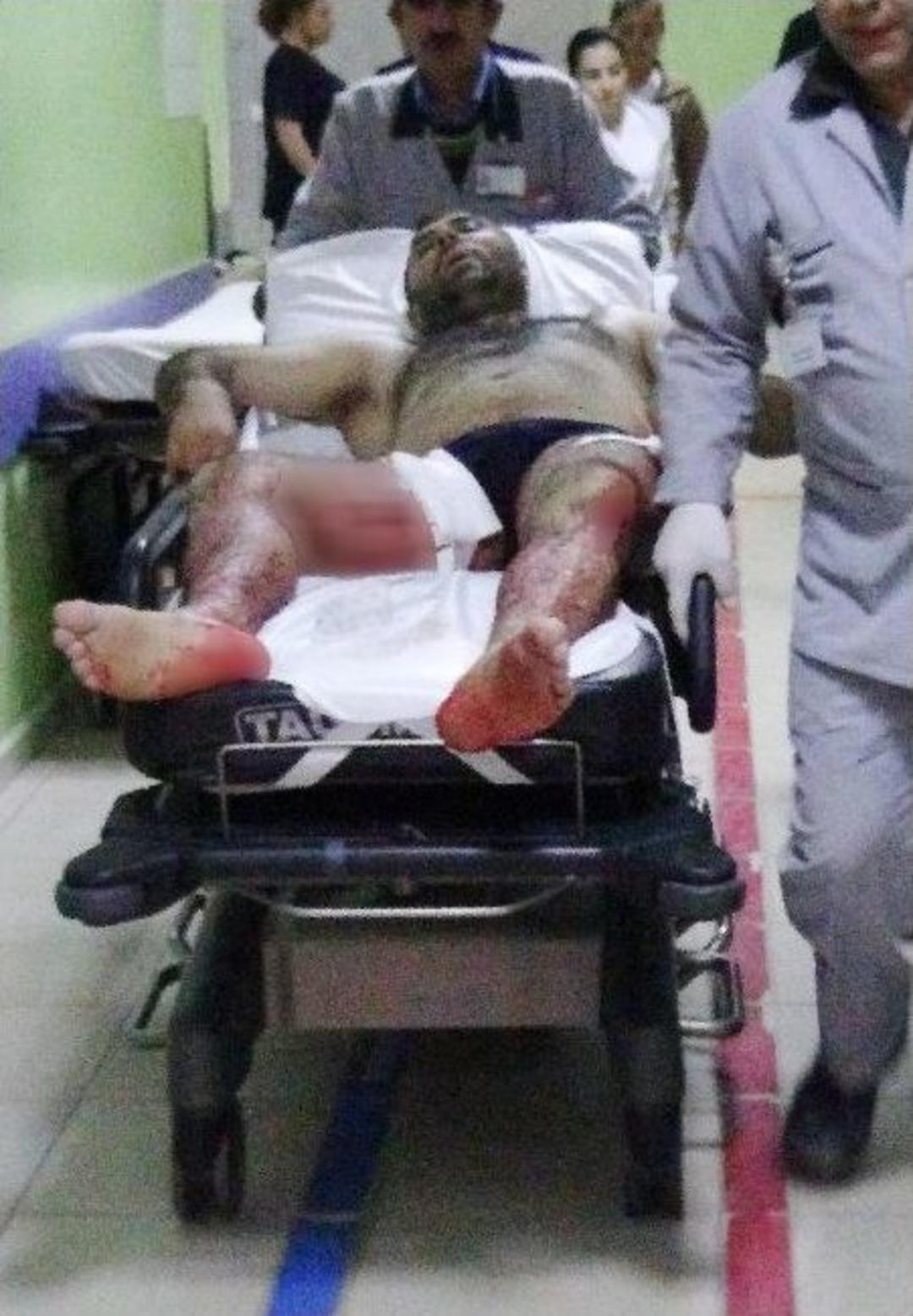 İş&ccedil;ilerin &Ccedil;ay Kavgası Kanlı Bitti: D&ouml;rt Yaralı