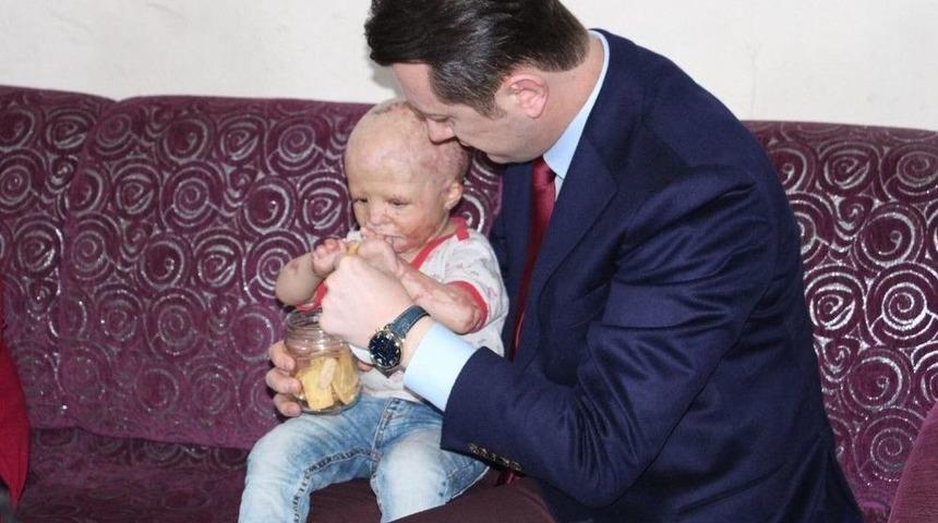 Ahmet Bebek Sağlığına Kavuşacak