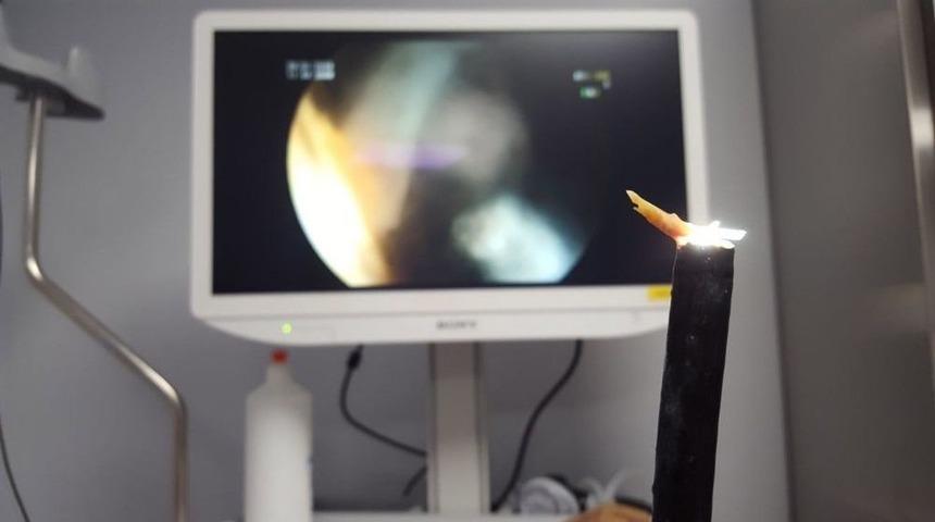 Tavuk Yerken Bağazına Saplanan Kemik Hastanelik Etti