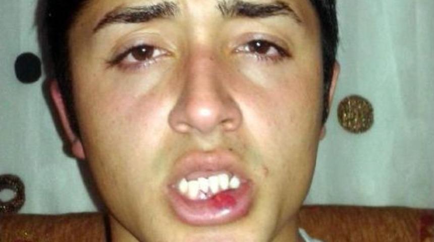 &Ouml;ğrenciye Halı Sahanın Asma Kilidiyle Dayak