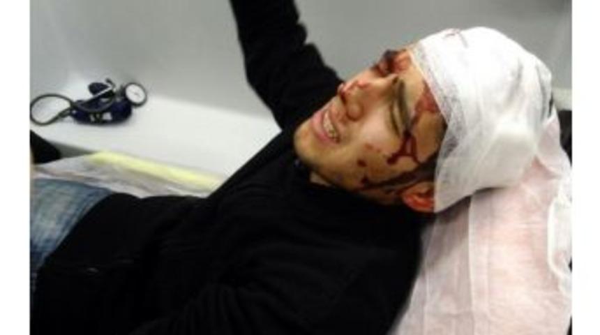 Ev Sahibi Hırsızı Hastanelik Etti