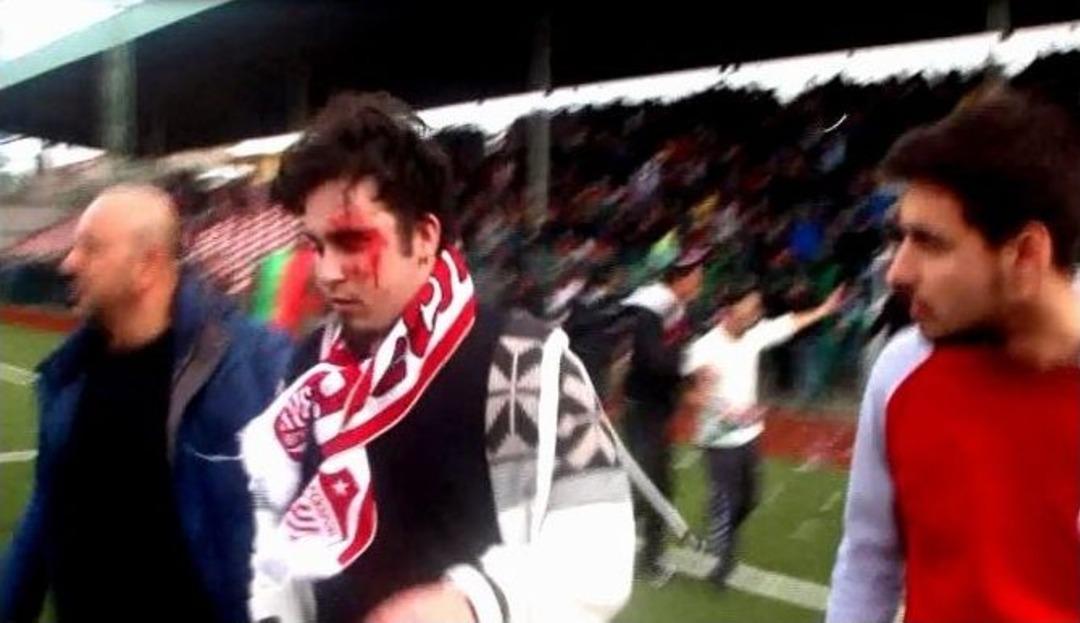 Amat&ouml;r Ma&ccedil;ta Ortalık Savaş Alanına D&ouml;nd&uuml;