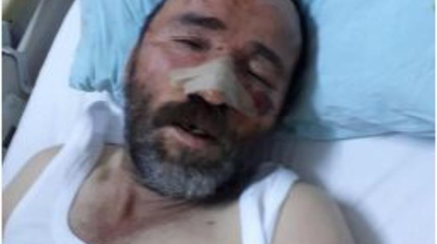 İnşaattan Düşen İşçi Yaralandı