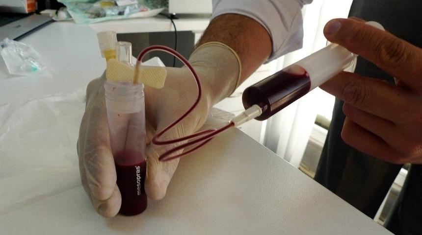 &ldquo;diz Kire&ccedil;lenmesinin Tedavisi Kendi Kanımızda Gizli&rdquo;