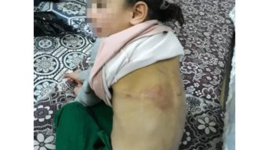 &Ccedil;ocuğuna İşkence Yapan Suriyeli Baba Tutuklandı