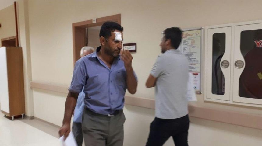 Motorlu Testere İle Y&uuml;z&uuml;n&uuml; Kesti