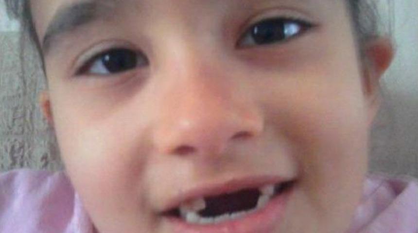 &Ccedil;ocuğunun Kalıcı Dişlerinin &Ccedil;ekildiğini S&ouml;yleyen Baba Şikayet&ccedil;i