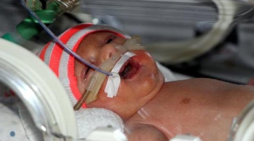 Kartal Bebek Yaşama Tutunamadı