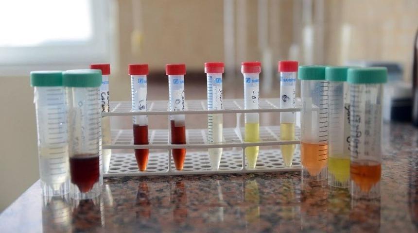 Elektronik Sigarada Gizli Tehlike: Aroma