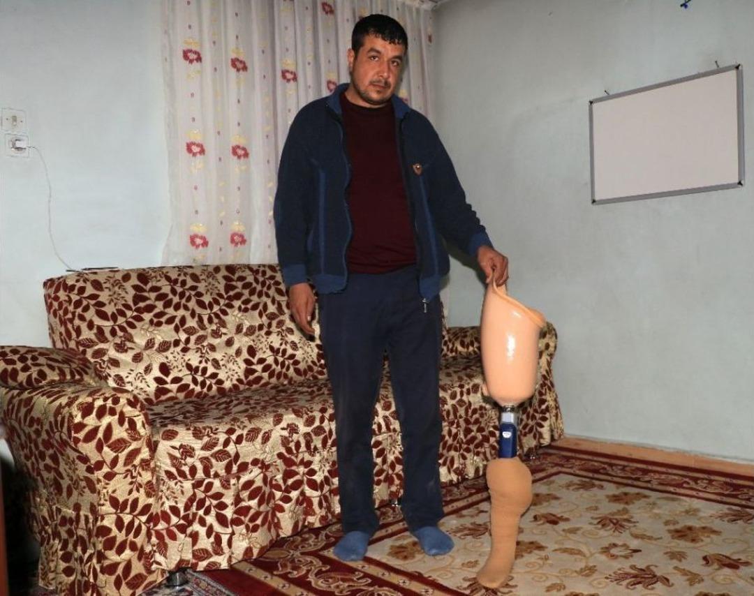 &Ouml;len Eşinin Protez Bacağını Bağışlayacak İhtiya&ccedil; Sahibi Arıyor