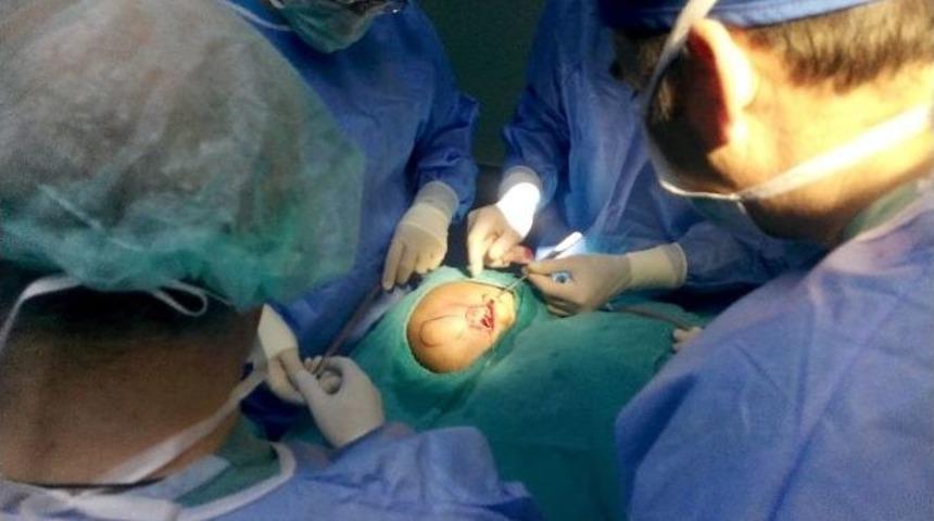 21 Aylık Bebeğe Biyonik Kulak