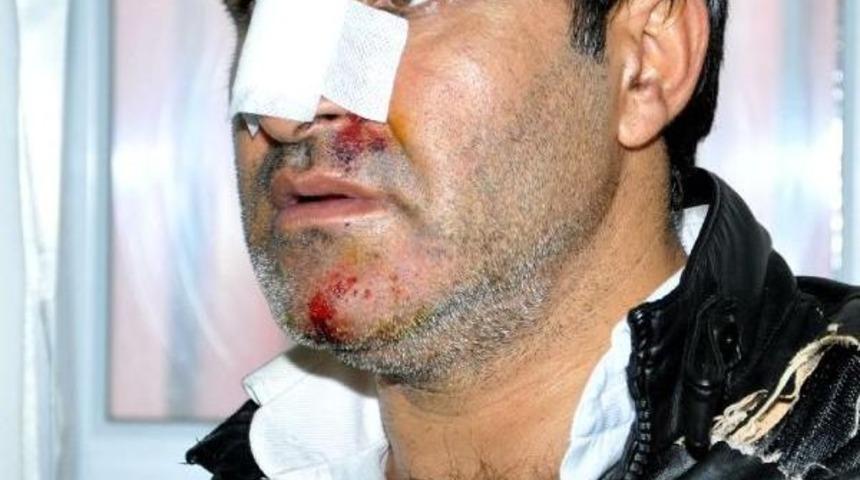 İş&ccedil;i Taşıyan Otob&uuml;sle Tır &Ccedil;arpıştı: 4 &Ouml;l&uuml;, 47 Yaralı (4)