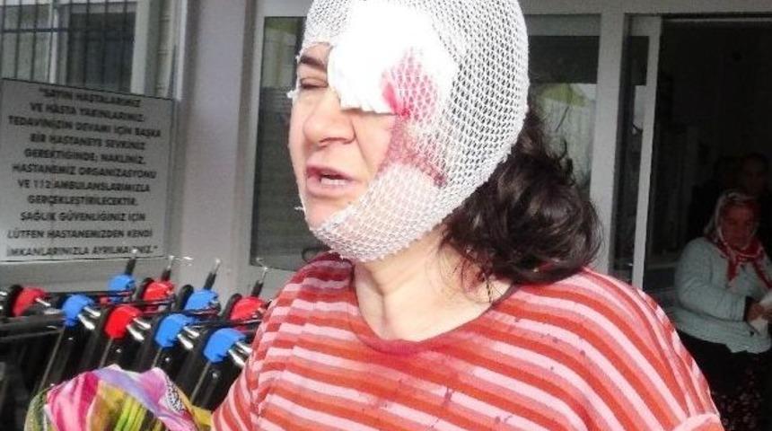 Eşi Ve &Ouml;ğretmen Kaynı Tarafından D&ouml;v&uuml;ld&uuml;