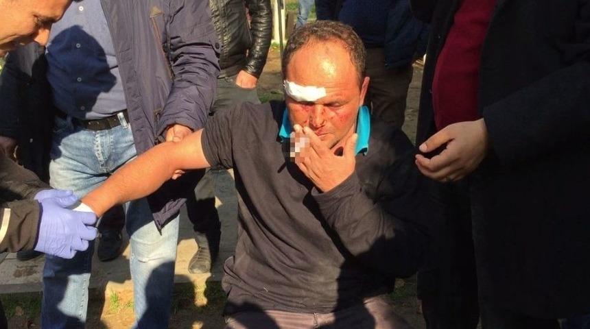 İhalede Tehdit Edilen Nakliyeci Feci Şekilde D&ouml;v&uuml;ld&uuml;