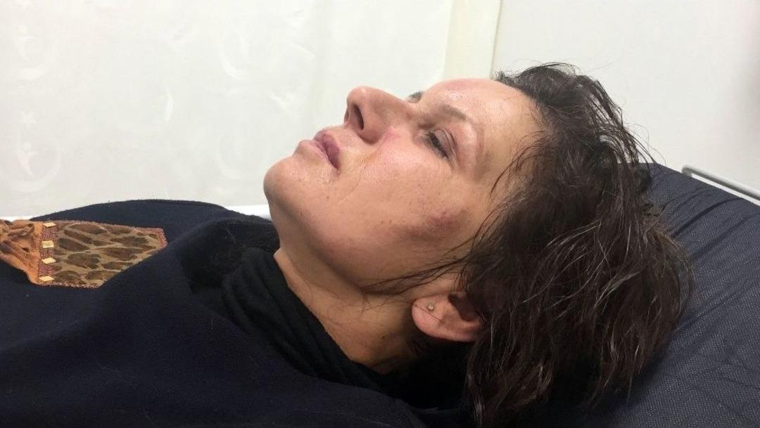 Kadın &Ouml;ğretmene Park Dayağı