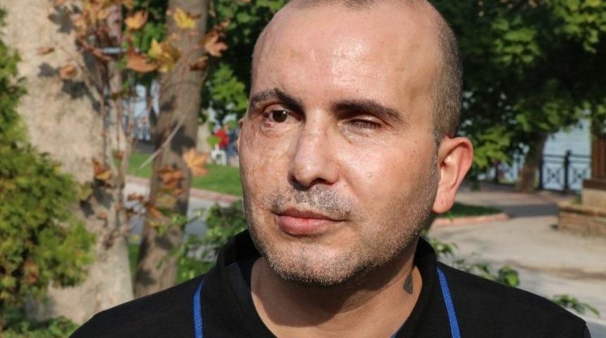 G&ouml;rme Engelliler Teknolojik Ara&ccedil;larda Kdv İndirimi Ve Vergi Muafiyeti İstiyor