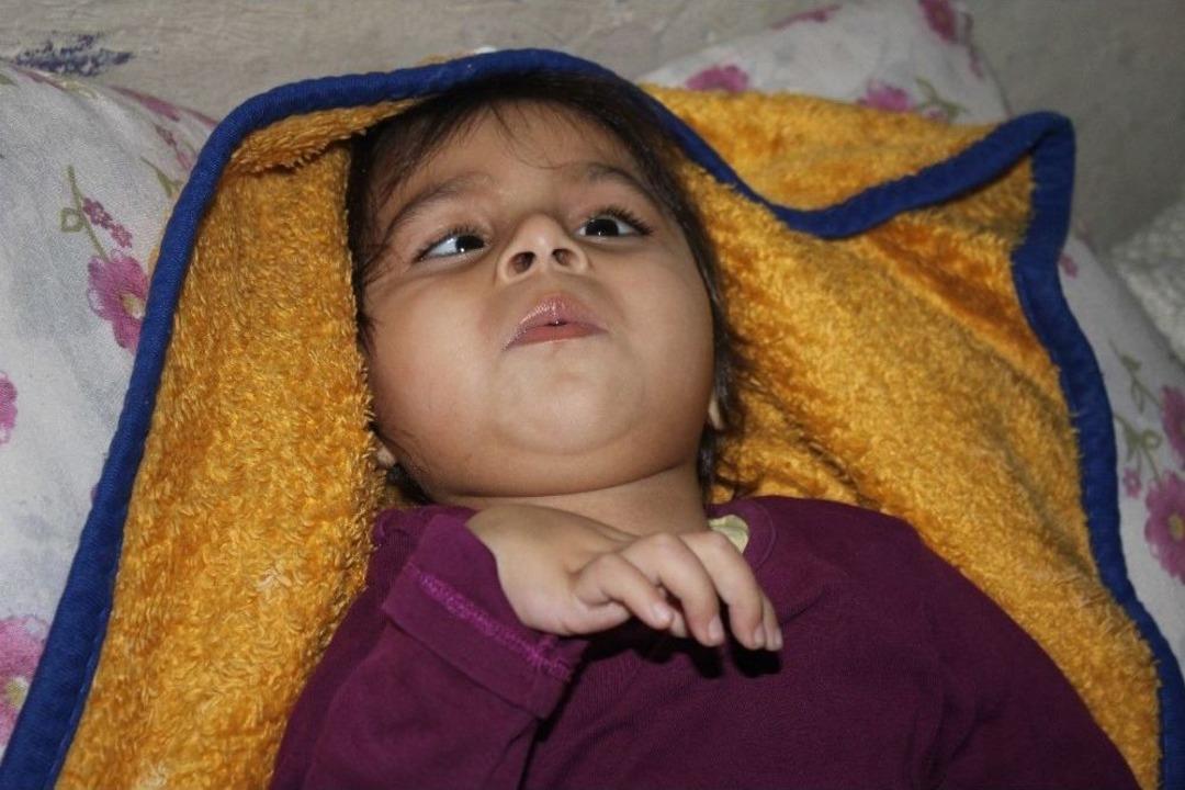 (&ouml;zel) Doğuştan Epilepsi Hastası 3 Yaşındaki Nazlı Yardım Elini Bekliyor