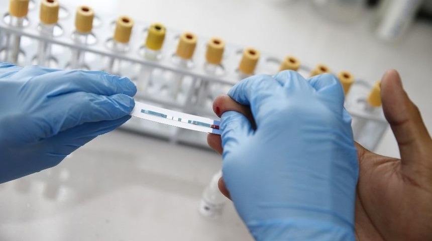 Konak Belediyesinden &Uuml;cretsiz Ve Anonim Hıv Testi