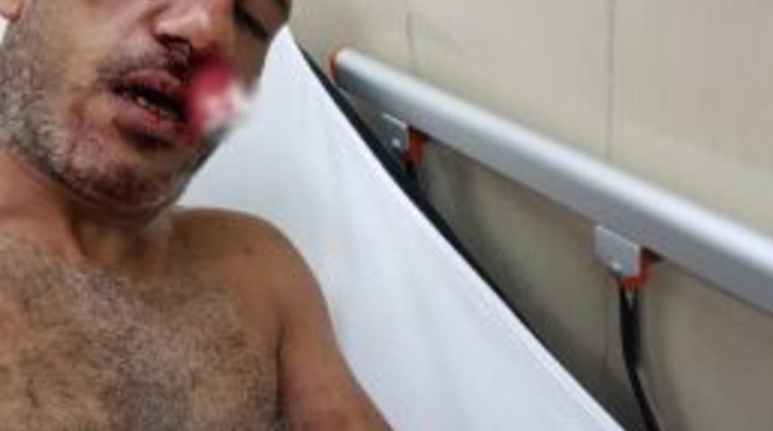 Borcunu Alamadığı Ortağını 2 Kişi İle D&ouml;v&uuml;p Bı&ccedil;akladı