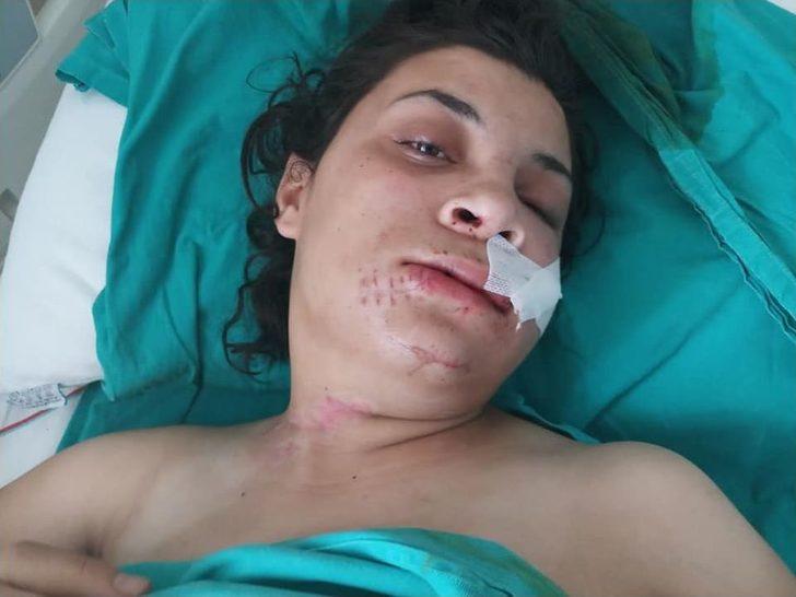 Eski Eşinin Yüzünü Şişeyle Parçaladı G2