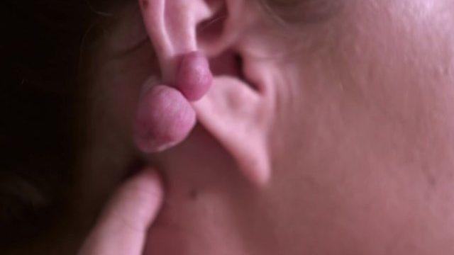 Kulağını deldirdi, bu hale geldi