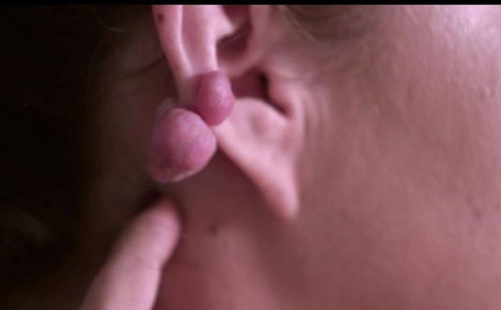 Kulağını deldirdi, bu hale geldi G5