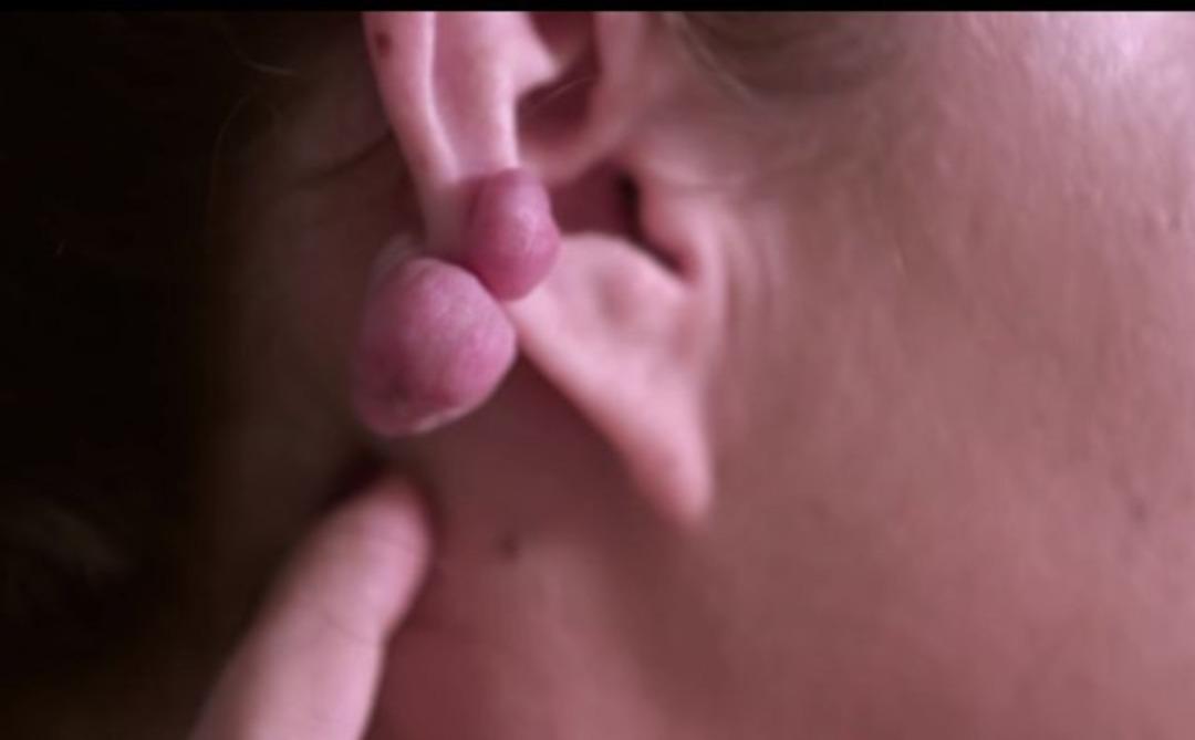 Kulağını deldirdi, bu hale geldi