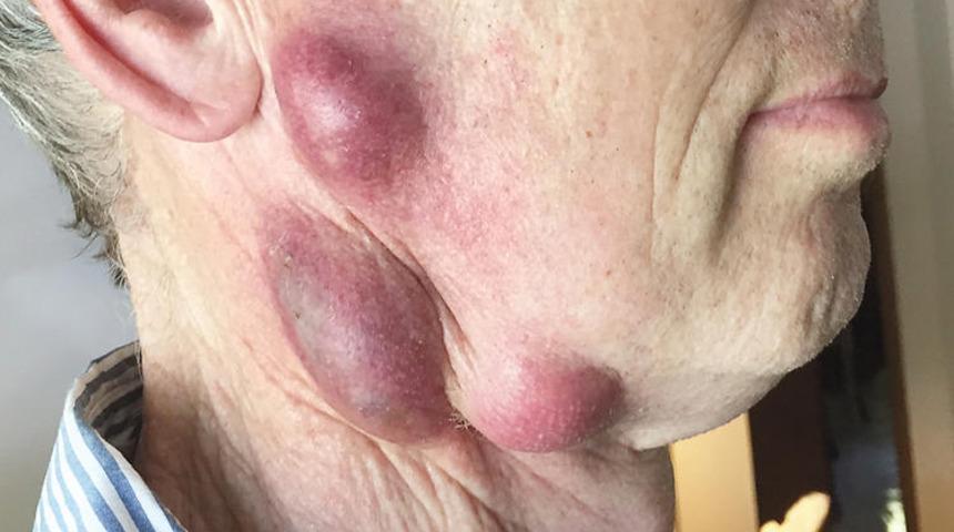 Evde beslediği kedisinden bulaştı! Ölümcül... 