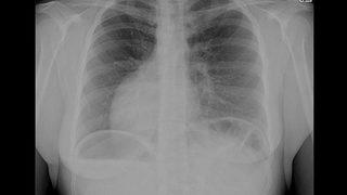 Ultrasonu çeken kişinin sözlerini duyunca dondu kaldı: Şu an kalbin atmıyor