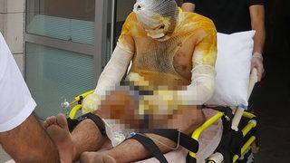 Kırşehir'deki tuz ocağında patlama! Yaralı işçiler var