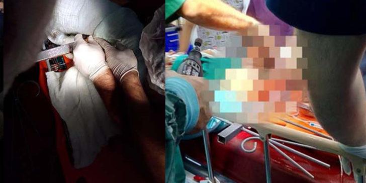Zonguldak'ta bacağına demir çubuk saplanan çocuğu kurtarmak için doktorlar ve AFAD ekipleri seferber oldu!
