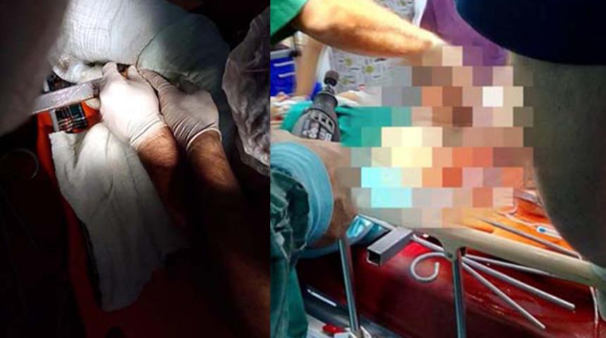 Zonguldak'ta bacağına demir çubuk saplanan çocuğu kurtarmak için doktorlar ve AFAD ekipleri seferber oldu!