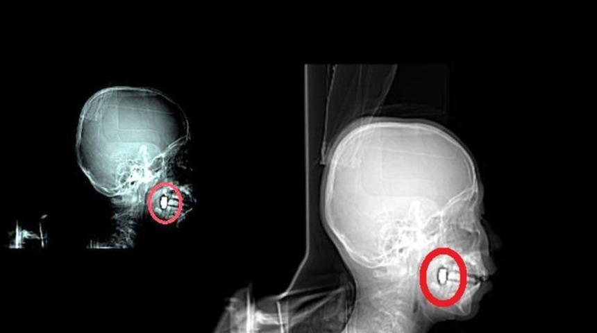 Annesine yardım ediyordu, bir anda bayıldı! Korkunç gerçek hastanede ortaya çıktı