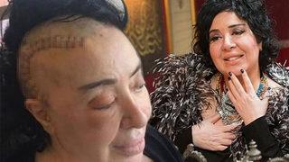 Nur Yerlitaş operasyon sonrası çekilen fotoğrafını paylaştı 