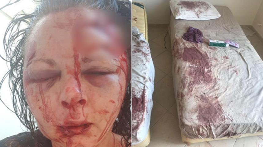 Marmaris'te rezalet! Cinsel ilişkiyi reddeden turisti hastanelik etti!