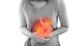 Mide yanmasına ne iyi gelir? Mide yanması için evde doğal tedavi yöntemleri nelerdir?