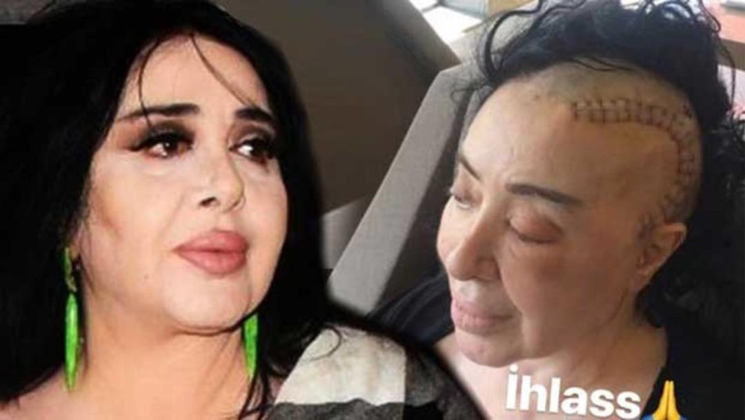 Nur Yerlitaş: Her g&uuml;n tedaviye gidiyorum