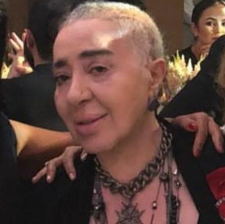 Nur Yerlitaş: Her gün tedaviye gidiyorum G2