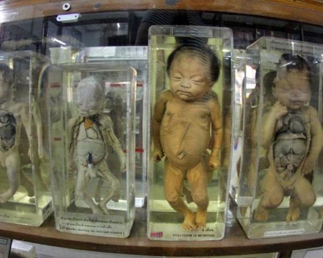 D&uuml;nyanın 'en tuhaf' m&uuml;zeleri belli oldu! T&uuml;rkiye'den tek bir m&uuml;ze listede 