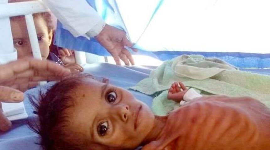 BM korkunç raporu açıkladı: Her 1 dakikada 12 çocuk can veriyor