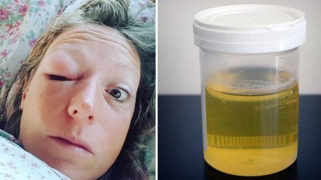 Su gibi içiyor! Bu kadının günde 2 bardak idrar içmesinin bir sebebi var