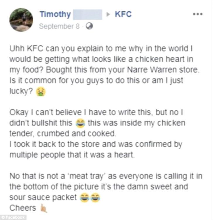  Çıtır tavuk diye aldı, içinden bakın ne çıktı G3