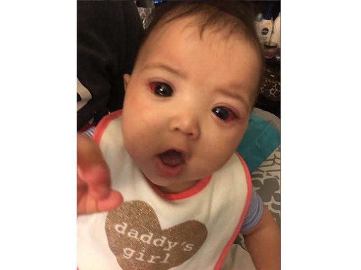 Çizgi film karakteri gibi gözleri var!  G3